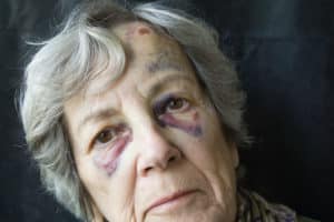 Elder Abuse Attorney in Glendale AZ